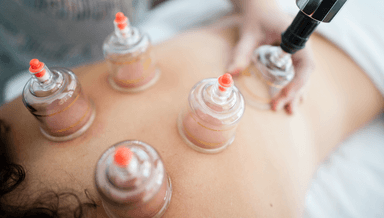 Image for Cupping Massage 60min